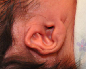 Ear Well